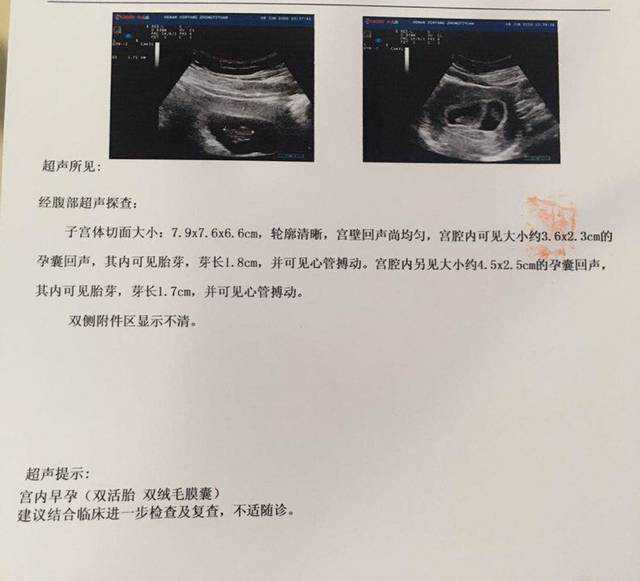 北京代孕怎么做的-北京正规代孕公司排名的必要性